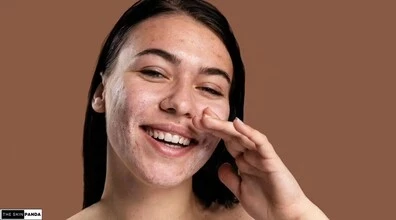 Dry Skin
