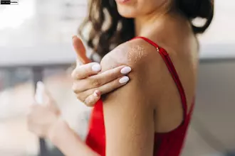 Persistent Dry Skin
