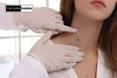 Benefits and Potential Drawbacks of Tea Tree Oil