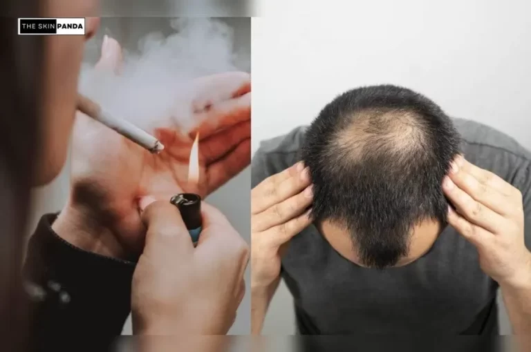 Does Nicotine Cause Hair Loss?
