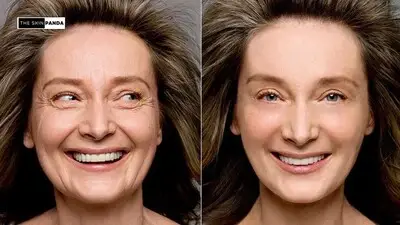 Does Retinol Tighten Saggy Skin